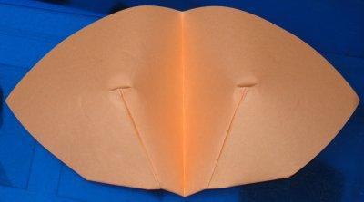 Breasts